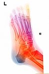 ankle-and-foot-colorful-image-100162292